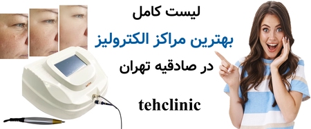 لیست کامل بهترین مراکز الکترولیز در صادقیه تهران