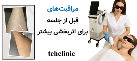 مراقبت‌های قبل از جلسه برای اثربخشی بیشتر