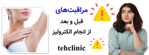 مراقبت‌های قبل و بعد از انجام الکترولیز