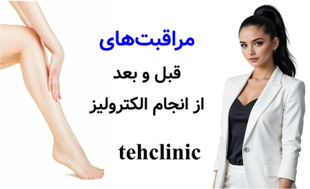 مراقبت‌های قبل و بعد از انجام الکترولیز