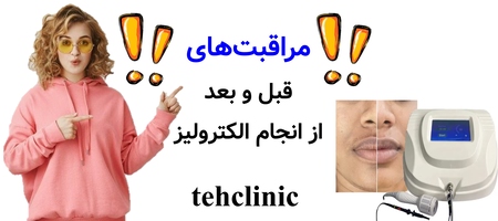 مراقبت‌های قبل و بعد از انجام الکترولیز