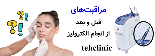 مراقبت‌های قبل و بعد از انجام الکترولیز