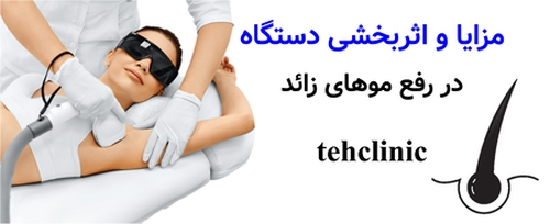 مزایا و اثربخشی دستگاه در رفع موهای زائد