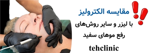 مقایسه الکترولیز با لیزر و سایر روش‌های رفع موهای سفید