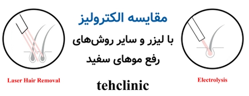 مقایسه الکترولیز با لیزر و سایر روش‌های رفع موهای سفید