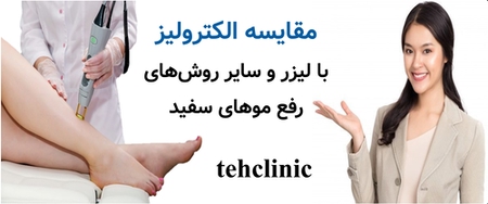 مقایسه الکترولیز با لیزر و سایر روش‌های رفع موهای سفید