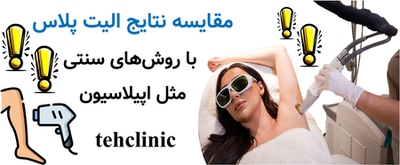 مقایسه نتایج الیت پلاس با روش‌های سنتی مثل اپیلاسیون