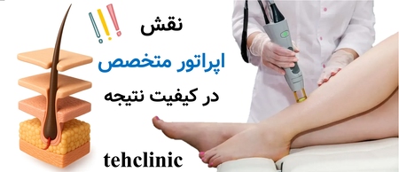 نقش اپراتور متخصص در کیفیت نتیجه