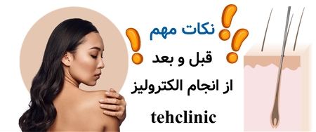 نکات مهم قبل و بعد از انجام الکترولیز