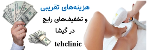 هزینه‌های تقریبی و تخفیف‌های رایج در گیشا