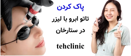 پاک کردن تاتو ابرو با لیزر در ستارخان