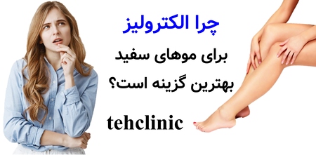 چرا الکترولیز برای موهای سفید بهترین گزینه است؟