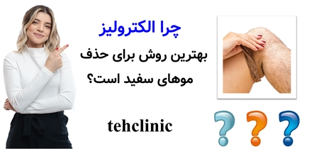 چرا الکترولیز بهترین روش برای حذف موهای سفید است؟