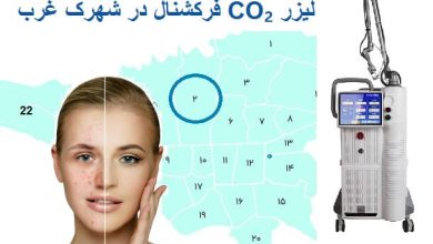 لیزرر فرکشنال در شهرک غرب