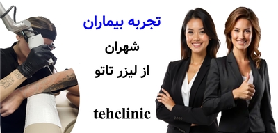 تجربه بیماران شهران از پاک کردن تاتو