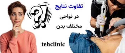 تفاوت نتایج در نواحی مختلف بدن