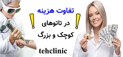 تفاوت هزینه در تاتوهای کوچک و بزرگ