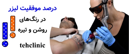 درصد موفقیت لیزر در رنگ‌های روشن و تیره