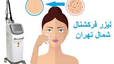 درمان جای جوش با لیزر CO₂ فرکشنال در شمال تهران