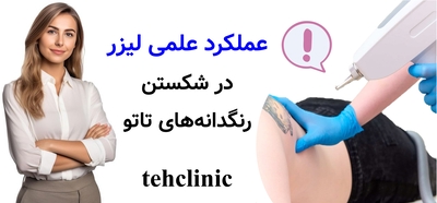 عملکرد علمی لیزر در شکستن رنگدانه‌های تاتو