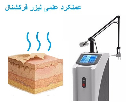 عملکرد علمی لیزر CO₂ در بازسازی لایه‌های عمقی پوست