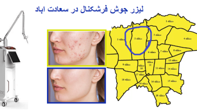 لیزر جوش فرشکنال CO2 سعادت آباد