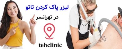 لیزر پاک کردن تاتو تهرانسر