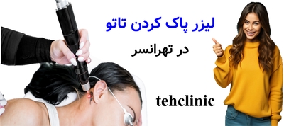لیزر پاک کردن تاتو در تهرانسر