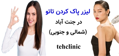 لیزر پاک کردن تاتو در جنت‌آباد (شمالی و جنوبی)