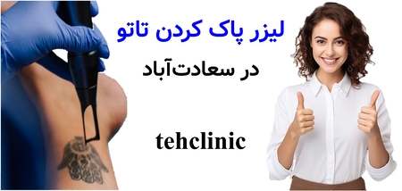 لیزر پاک کردن تاتو در سعادت‌آباد