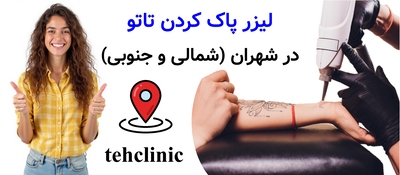 لیزر پاک کردن تاتو در شهران (شمالی و جنوبی)