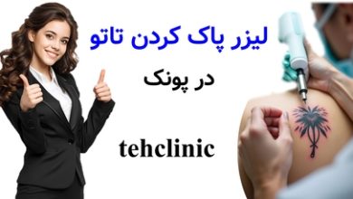 لیزر پاک کردن تاتو پونک