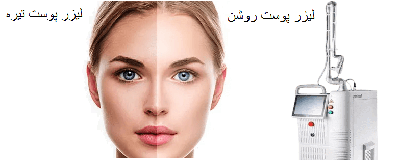 تفاوت نتایج در پوست‌های روشن و تیره چگونه است؟