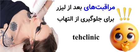 مراقبت‌های بعد از لیزر برای جلوگیری از التهاب