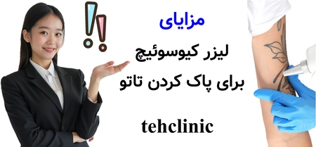 مزایای لیزر کیوسوئیچ برای پاک کردن تاتو