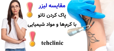 مقایسه لیزر پاک کردن تاتو با کرم‌ها و مواد شیمیایی