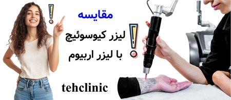مقایسه لیزر کیوسوئیچ با لیزر اربیوم
