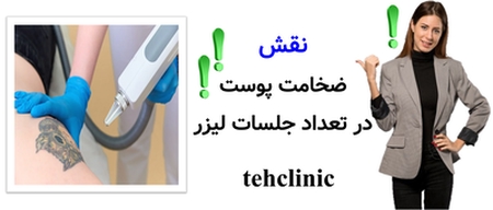 نقش ضخامت پوست در تعداد جلسات لیزر