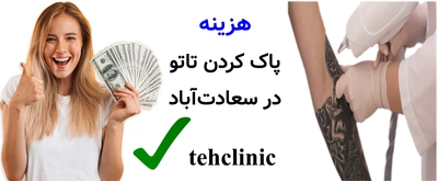 هزینه پاک کردن تاتو در سعادت‌آباد