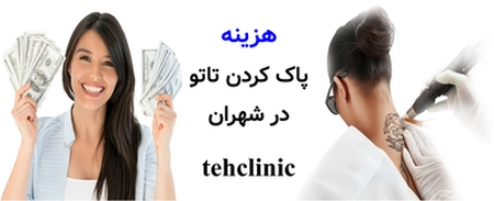 هزینه پاک کردن تاتو در شهران
