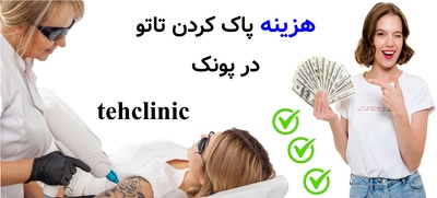 هزینه پاک کردن تاتو در پونک