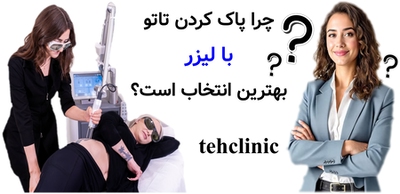 چرا پاک کردن تاتو با لیزر بهترین انتخاب است؟