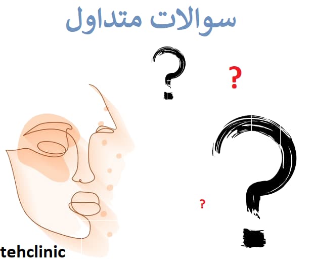 سوالات متداول