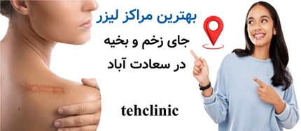 بهترین مراکز لیزر جای زخم و بخیه در سعادت آباد