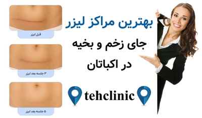 بهترین مراکز لیزر جای زخم و بخیه در اکباتان