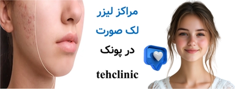 مراکز لیزر لک صورت در پونک