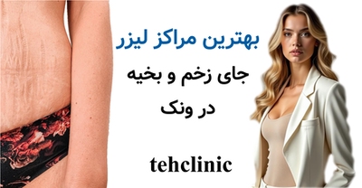 بهترین مراکز لیزر جای زخم و بخیه در ونک