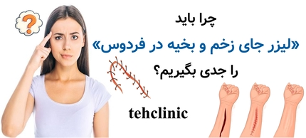 چرا باید «لیزر جای زخم و بخیه در فردوس» را جدی بگیریم؟