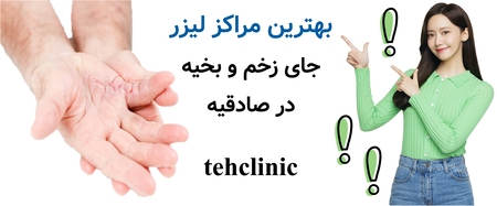 بهترین مراکز لیزر جای زخم و بخیه در صادقیه