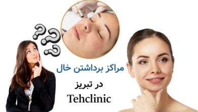 مراکز برداشتن خال در تبریز